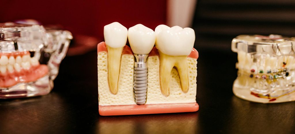 dental examples that create waste